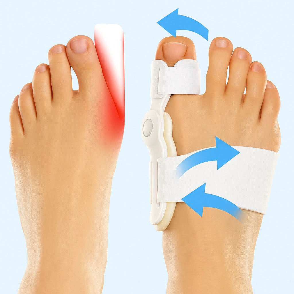Corrector de Juanetes - Hallux-valgus